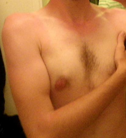 Bifogad bild