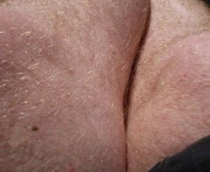 Bifogad bild